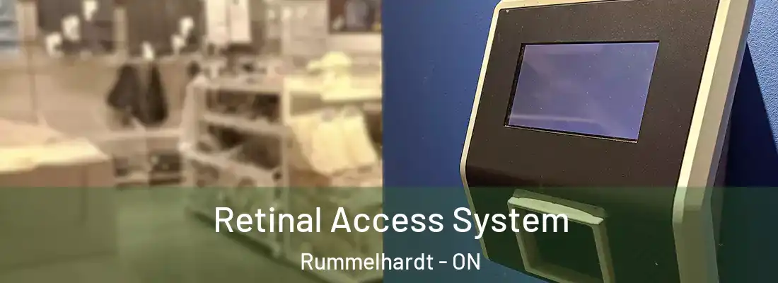  Retinal Access System Rummelhardt - ON